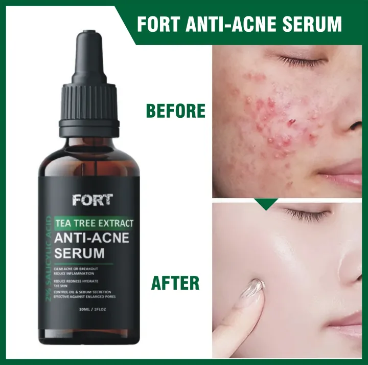 FORT Salicylic Acid Serum – Anti-Acne Face Serum