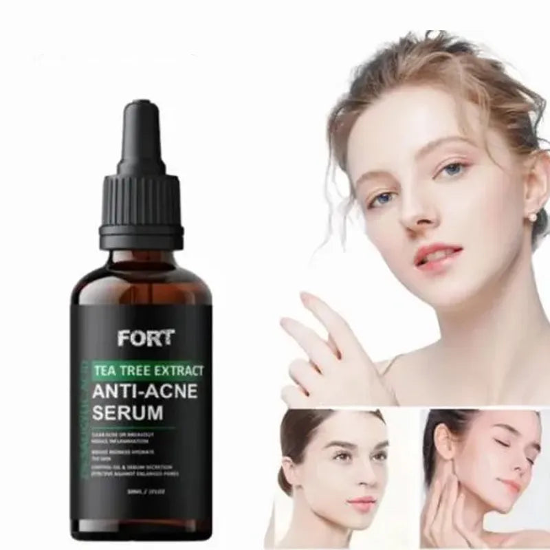 FORT Salicylic Acid Serum – Anti-Acne Face Serum